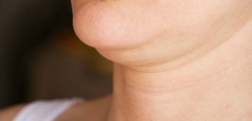 Double Chin Removal Safe and Effective Method.jpg