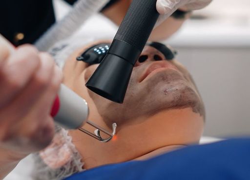 Spectra Laser Carbon Peel for Enhanced Facial Clar