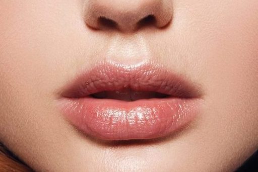 Bullhorn Lip Lift What Are the Long-Term Results.j