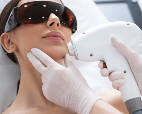 The Impact of Laser Hair Removal on Skin.png