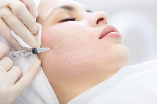 Everything You Need to Know About Skin Booster Inj