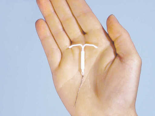 IUD Insertion Dubai.jpg